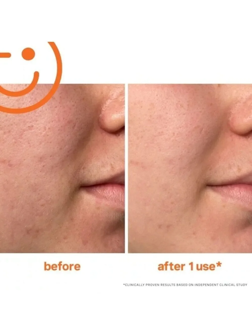 Kate Somerville ExfoliKate Intensive Exfoliating Treatment | NEW | Travel Size